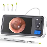 Digital Otoscope with 4.5 Inches Screen, Anykit 3.9mm Ear Camera with 6 LED Lights, 32GB Card, Ear Wax Removal Tool…